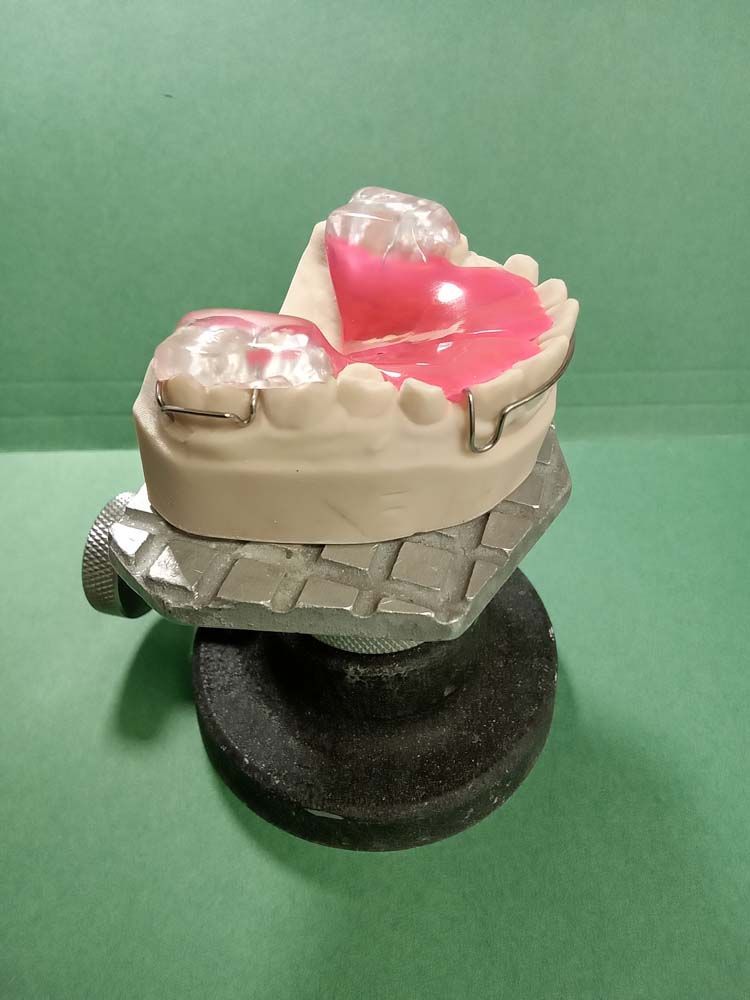 A model of a tooth with a pink tooth on top of it