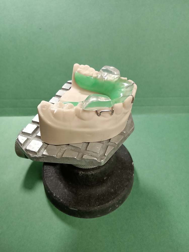 A model of a mouth with a green mouth guard on it