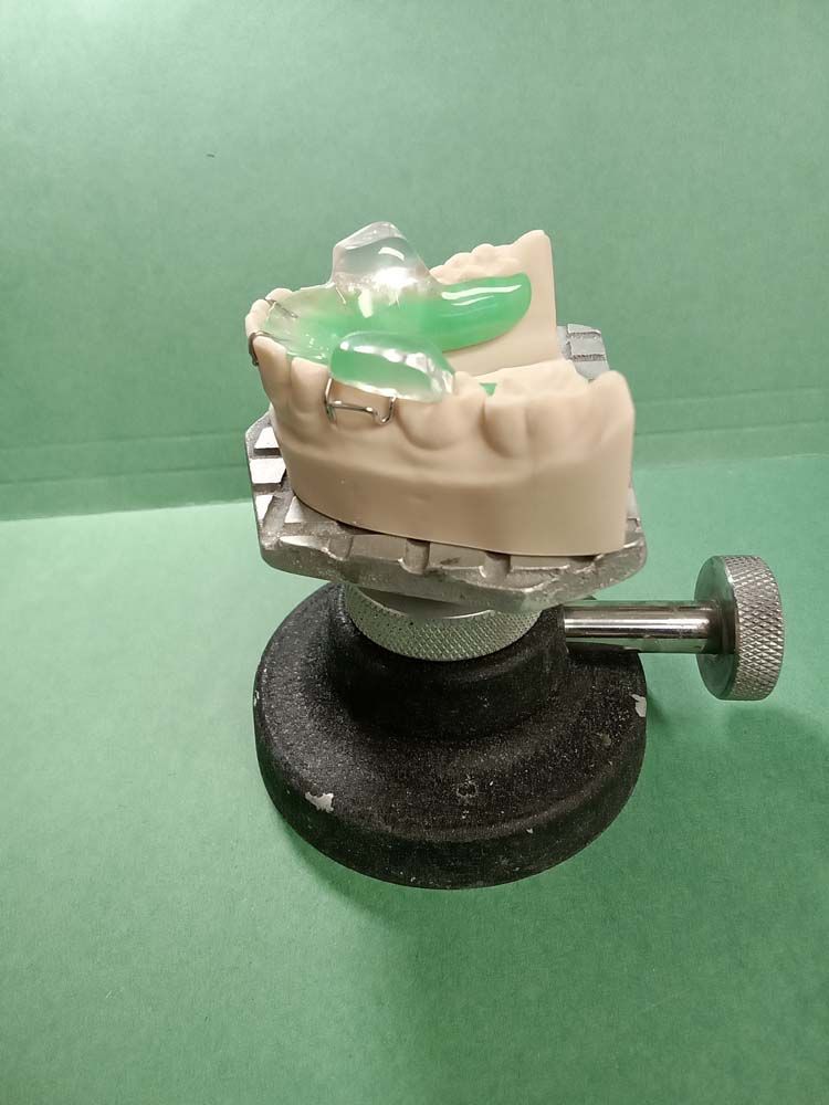 A model of a person's teeth is sitting on a green table.