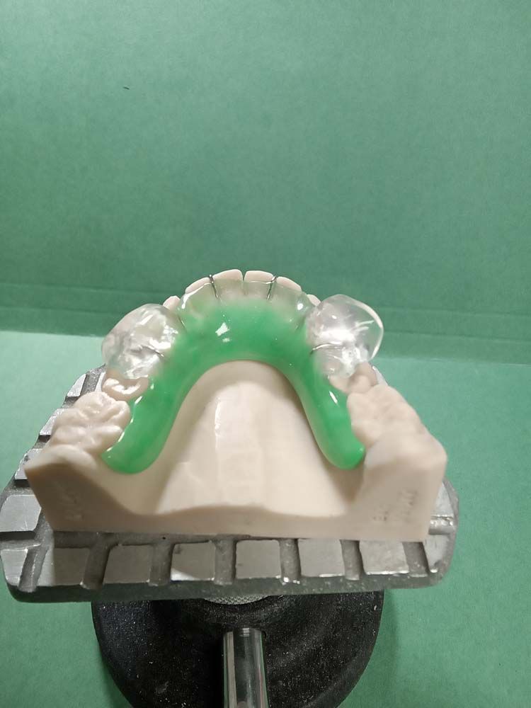 A model of a tooth with a green border is sitting on a table.