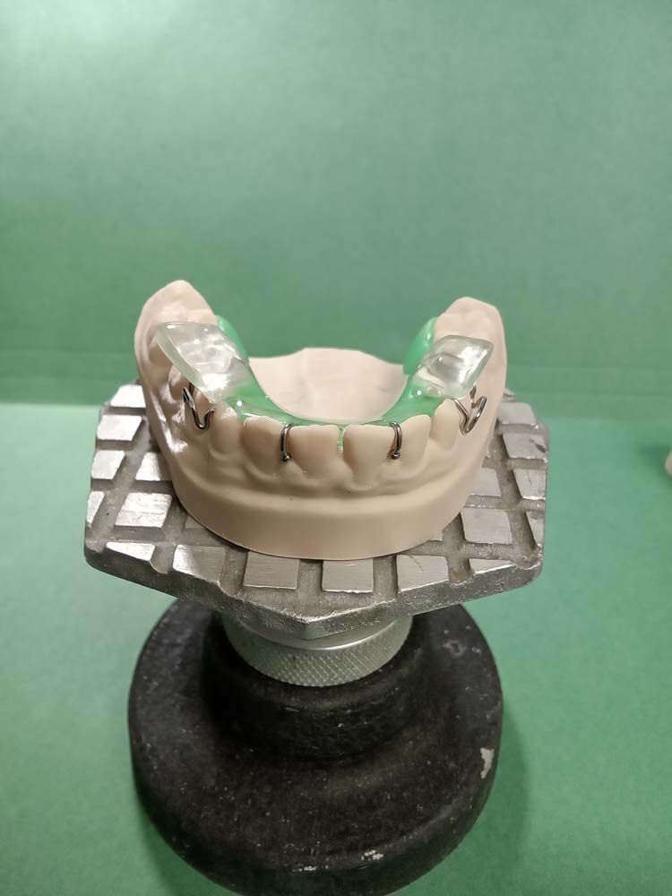 A model of a person's teeth is sitting on a table.