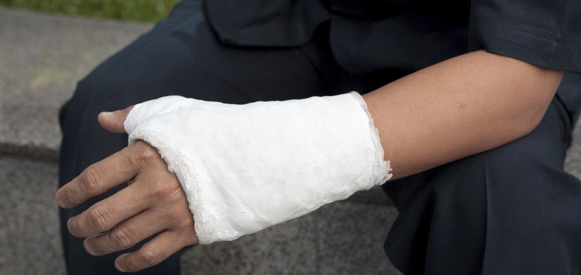 Closeup view of a man's hand and wrist in a cast