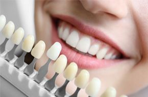 Woman choosing color of teeth at dentist