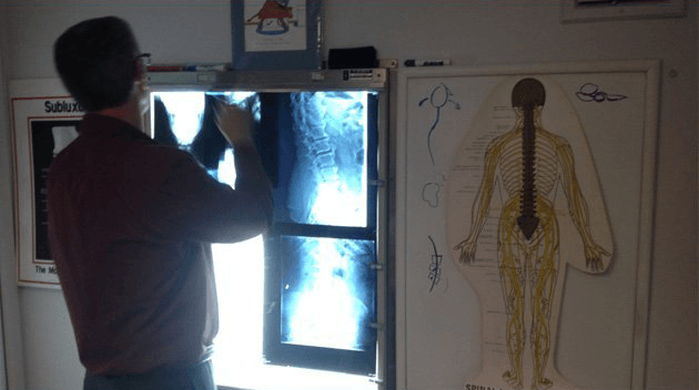 Doctor standing looking at the X-rays