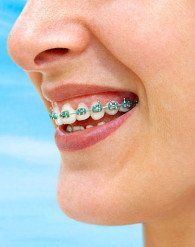 two-phase orthodontic treatment