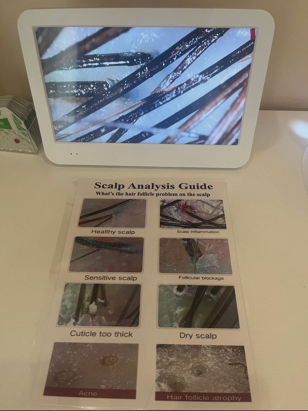 Scalp analysis guide display with close-up hair samples and labeled scalp condition examples