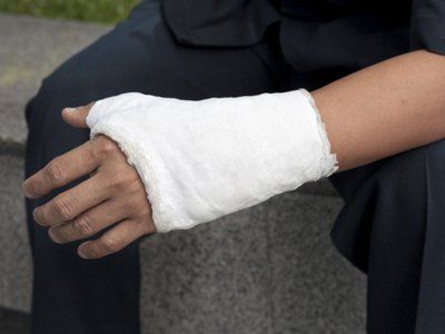 Injured hand
