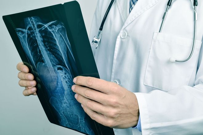 Doctor in white coat examining an X-ray of a chest.