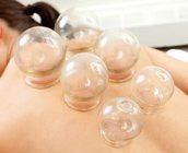 Fire cupping treatments