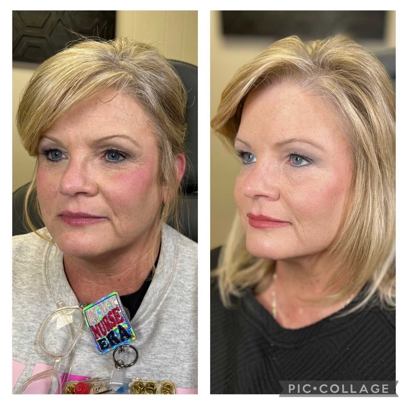 Two photos of a woman. Left photo, front view, right photo, profile view. She has blonde hair and is wearing makeup.