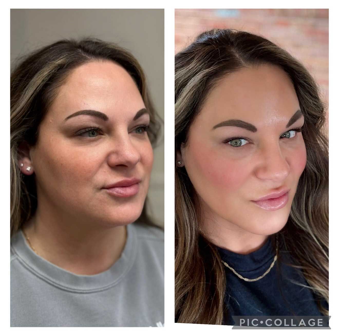 Side-by-side comparison of a person's face. Left side: before, right side: after. Visible brow lift and cosmetic enhancements.