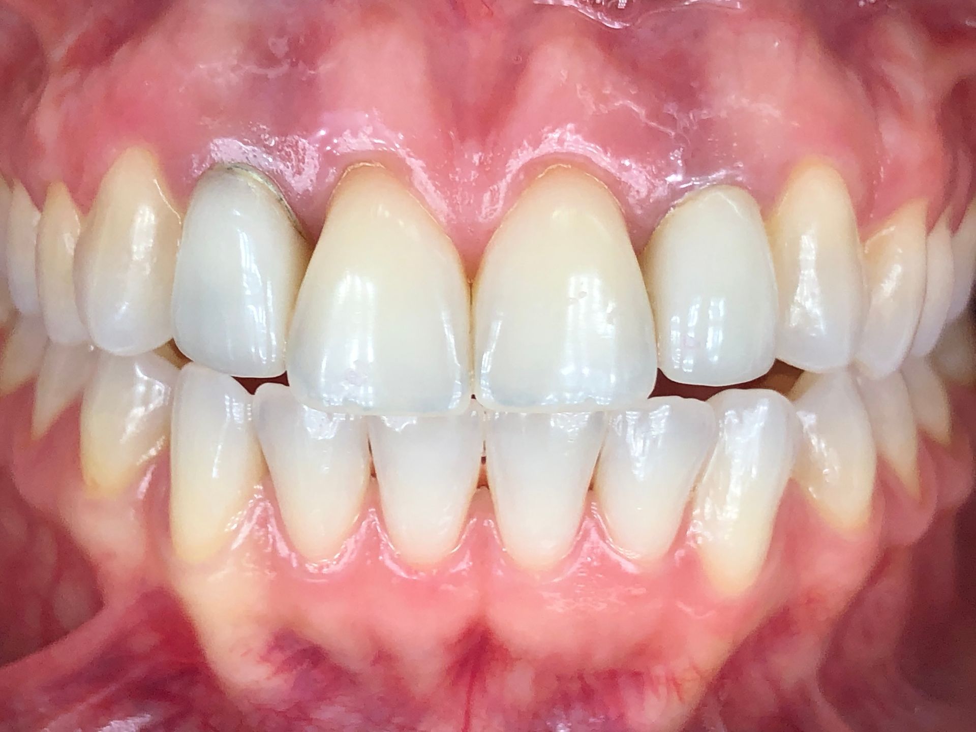 Close-up of a person's teeth, showing a well-aligned, white smile with healthy gums.