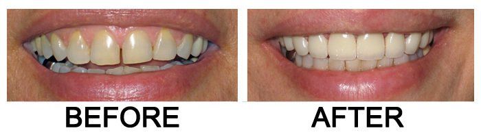 Glendora Dental Gallery