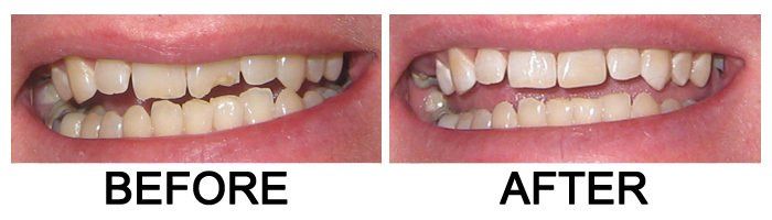 Glendora Dental Gallery