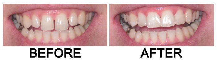 Glendora Dental Gallery