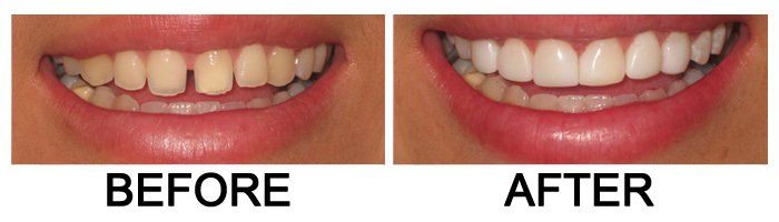 Glendora Dental Gallery