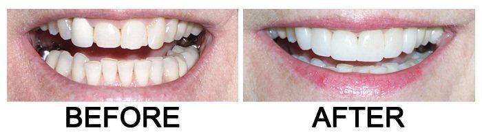 Glendora Dental Gallery