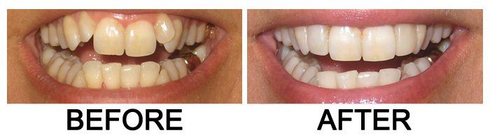 Glendora Dental Gallery