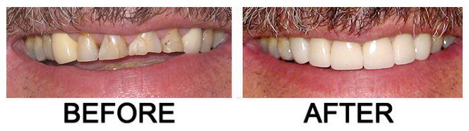 Glendora Dental Gallery