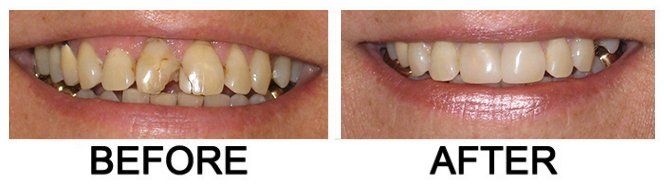 Glendora Dental Gallery