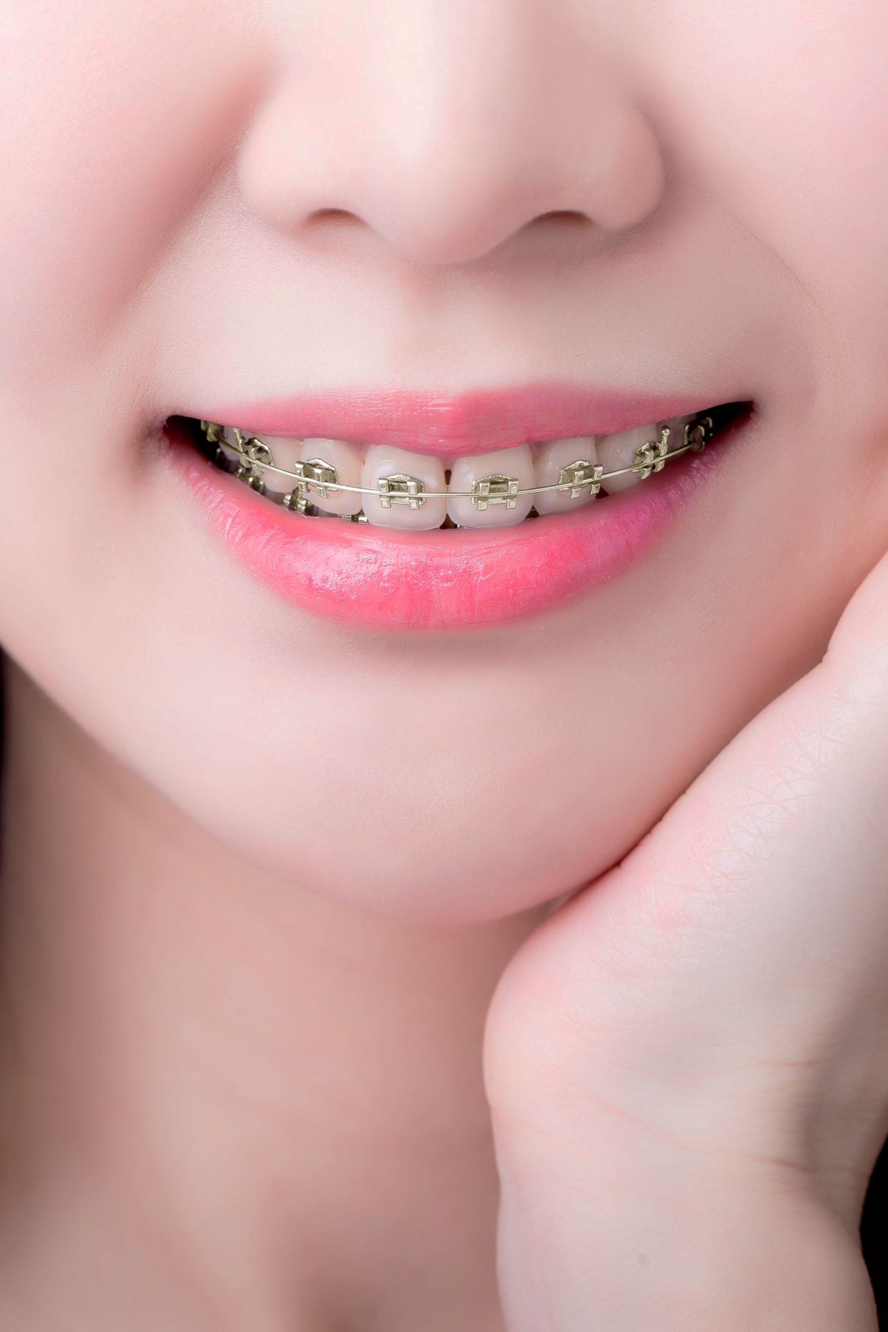 Close-up of a smiling mouth with pink lips and braces on the teeth