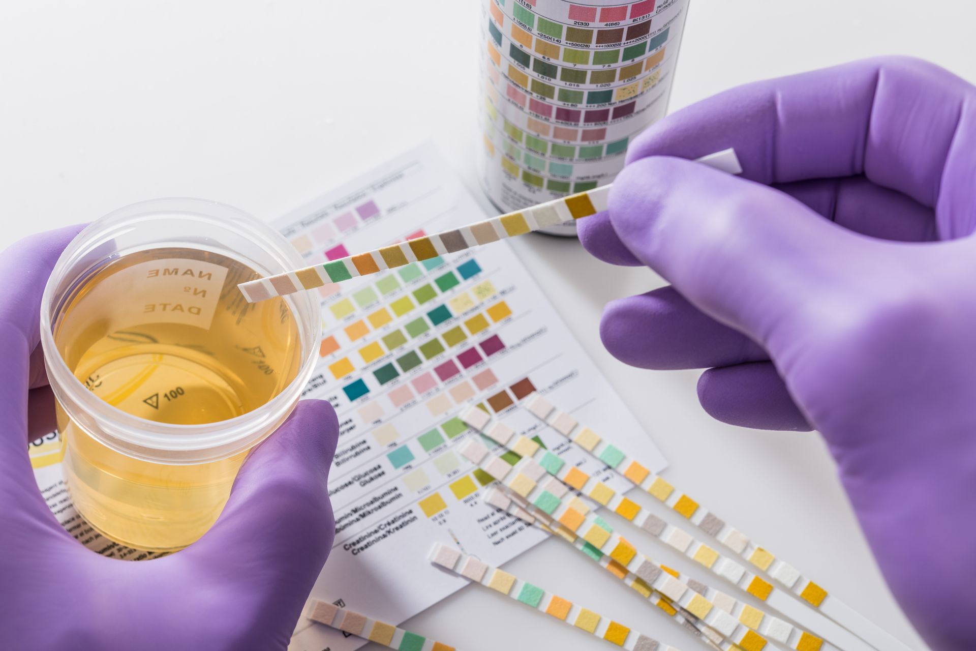 Drug Testing Laboratories | Cincinnati, OH | ODACS