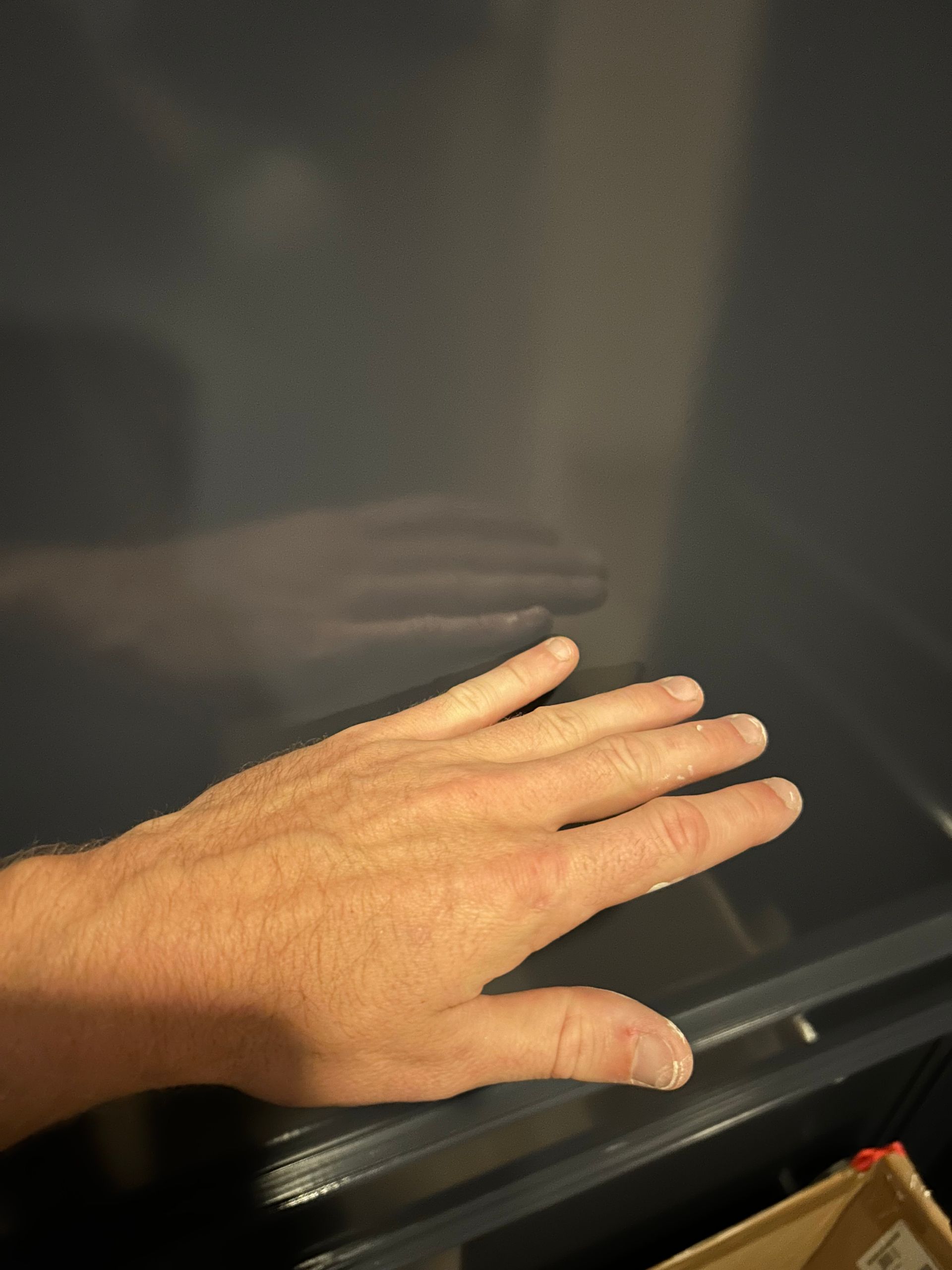 Hand resting on a dark surface, with a reflection of the hand visible.