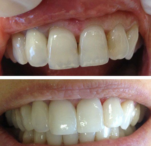 Before and after dental service