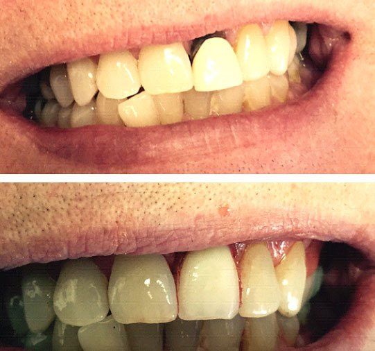 Before and after dental service