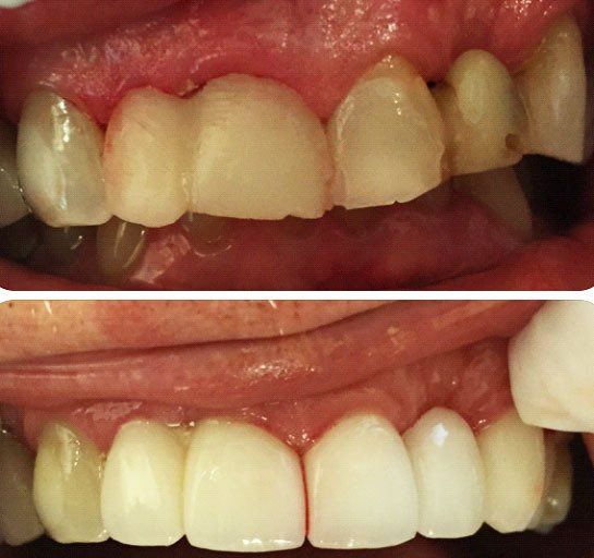 Before and after dental service