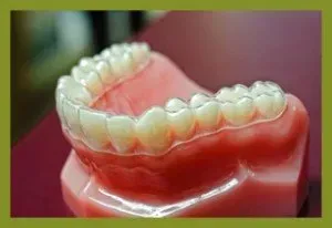 Custom Fitted Bite Guide