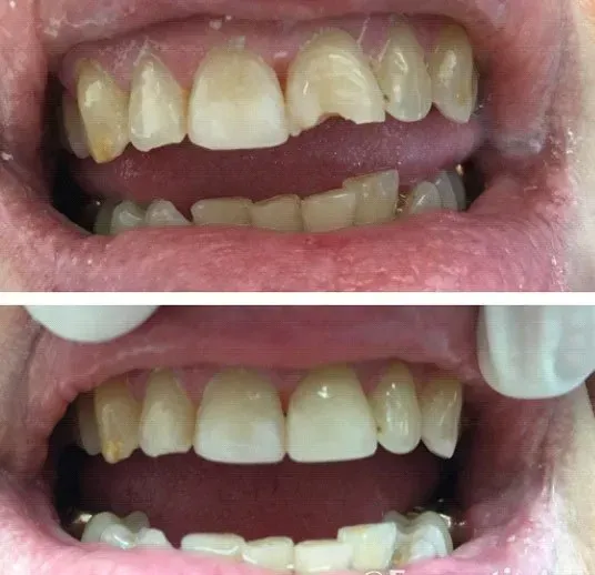 Before and after dental service
