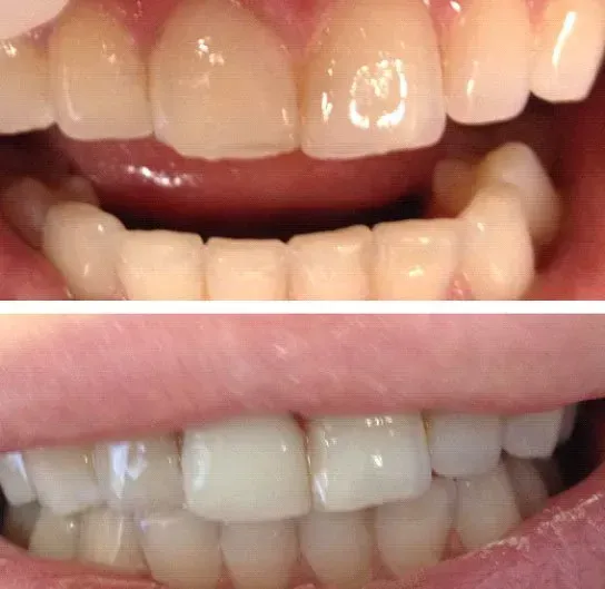 Before and after dental service