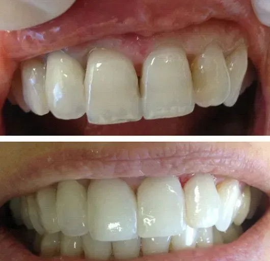 Before and after dental service
