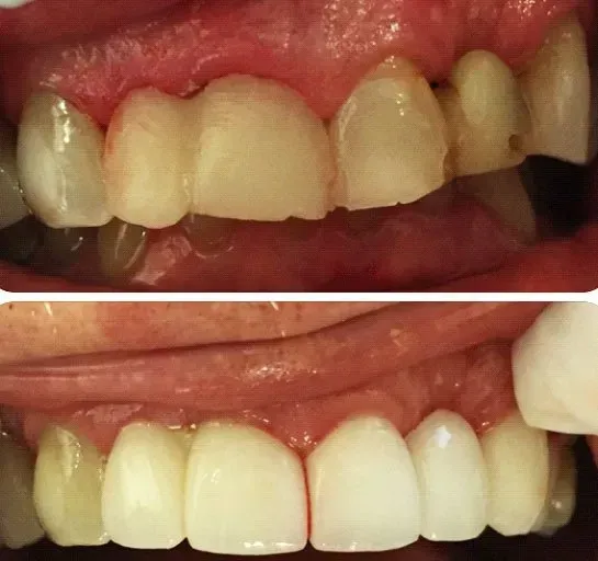 Before and after dental service