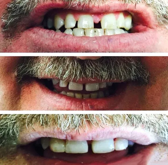 Before and after dental service