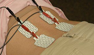 Learn More About Electric Simulation Electric stimulation