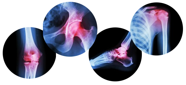 pain in joints highlighted