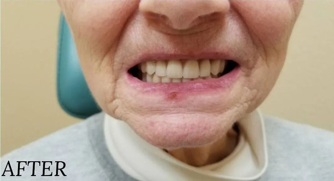 Close-up of a person's mouth with a full set of teeth, labeled