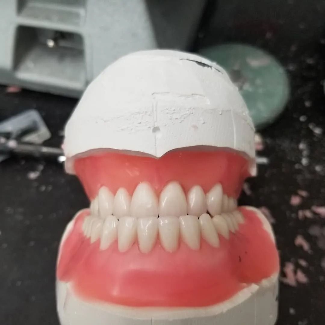 Dental model with artificial teeth set in pink gums, on a work surface.