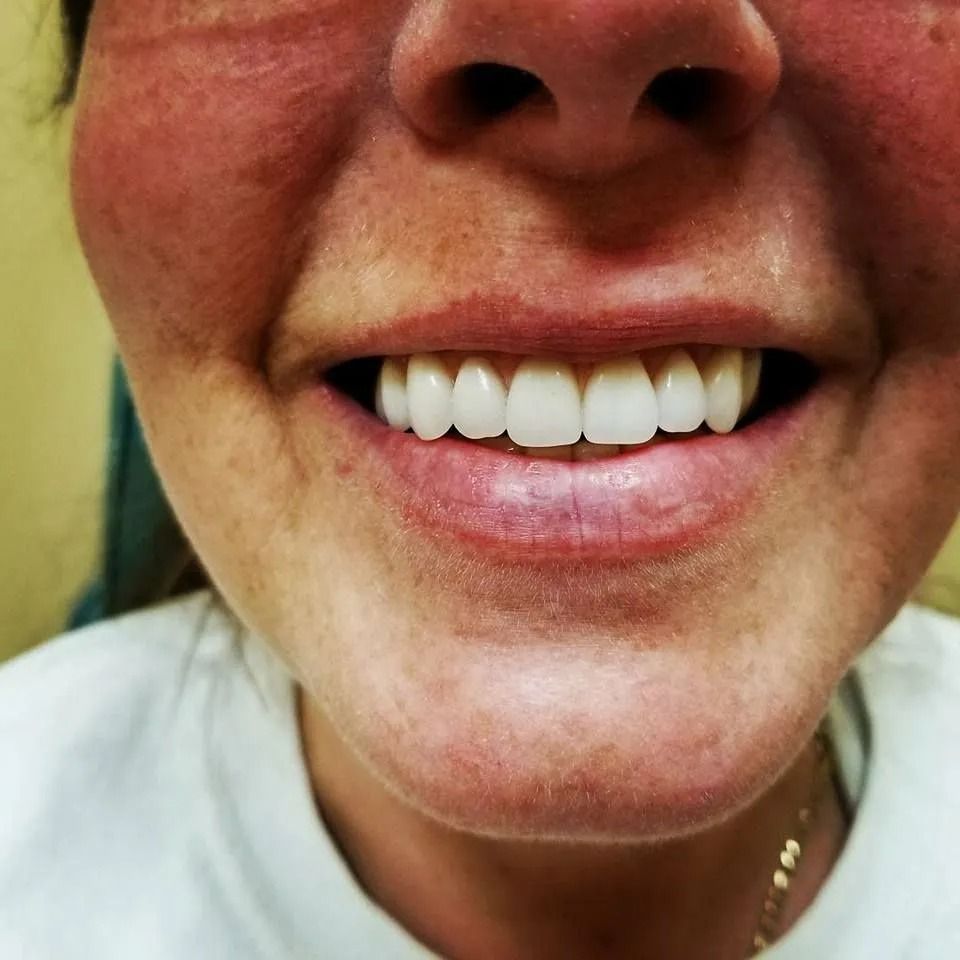 Close-up of a person smiling, revealing bright white teeth. Pink lips and skin are visible.