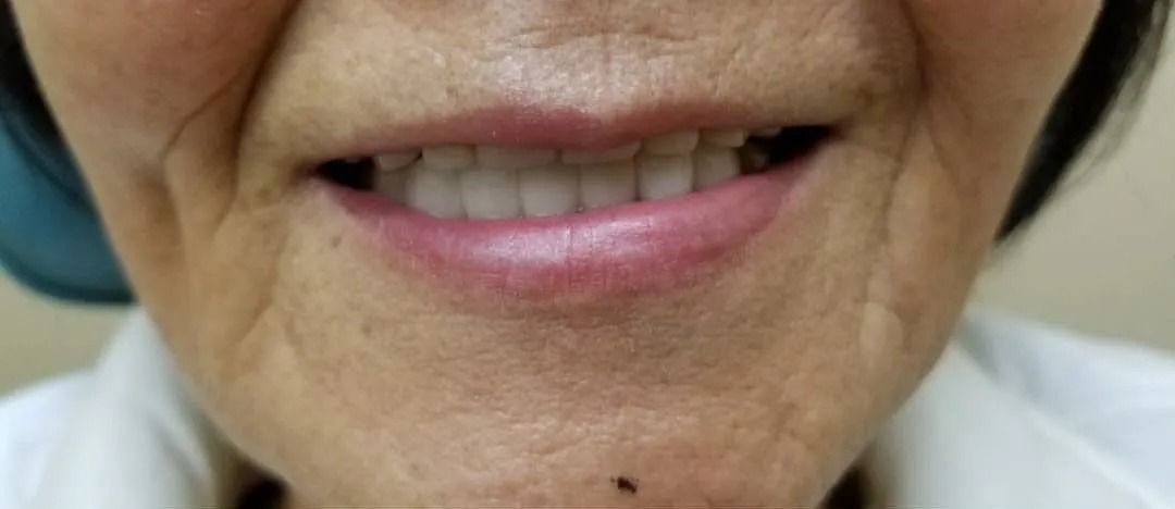 Close-up of a person's smiling mouth, lips are pink, teeth are white, skin has wrinkles.