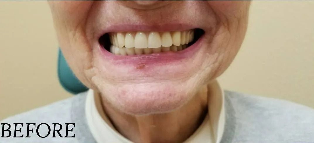 Close-up of a person's smiling mouth showing teeth labeled 