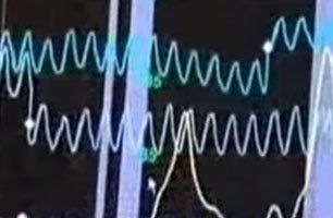 polygraph test