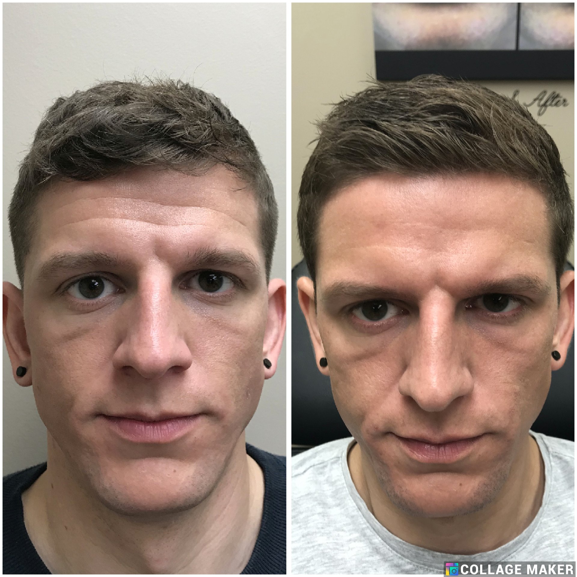 Babich Skin Care Estheticians Decatur, IL