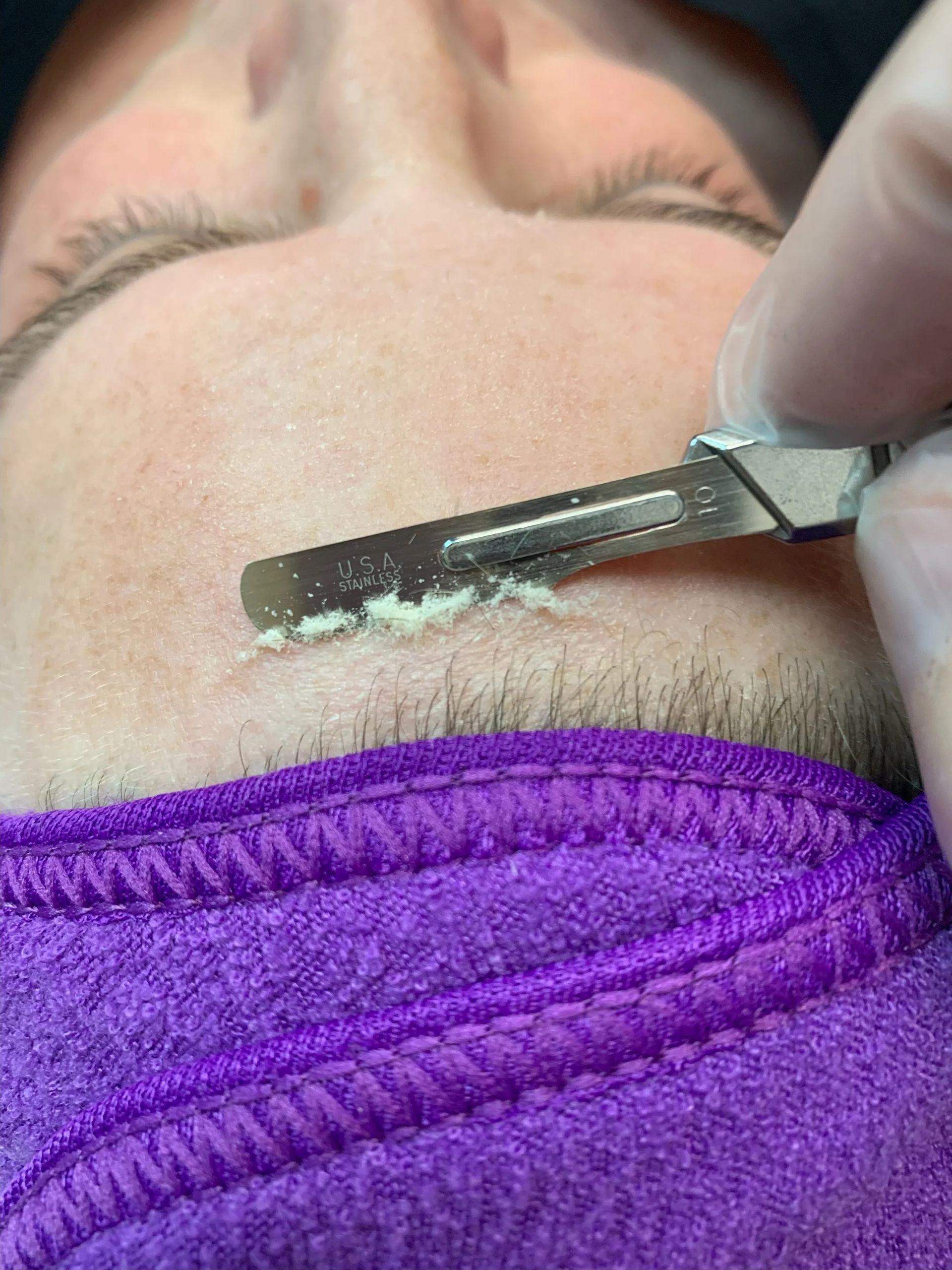 A person's forehead being shaved with a razor; purple cloth below.