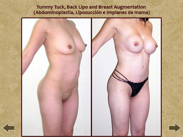Before and after body enhancements