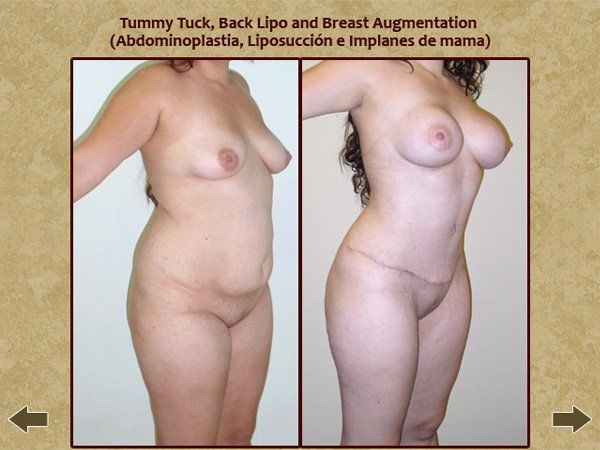 Before and after body enhancement