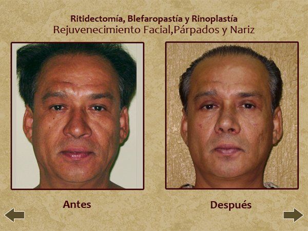 Man before and after pic