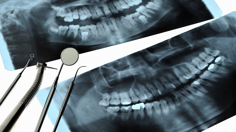 Dental tools and x-ray